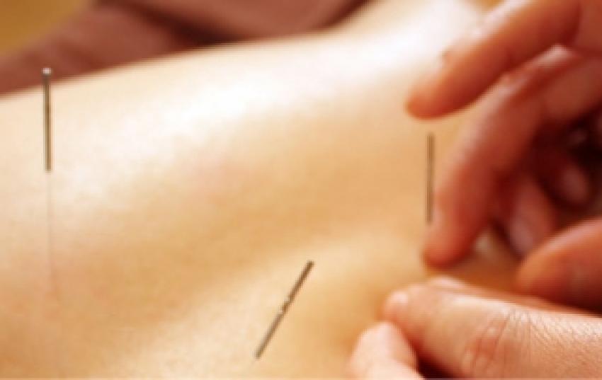 Reiki and acupuncture